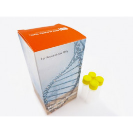 Bacterial Protein Lysis Buffer, 1x Stength Solution